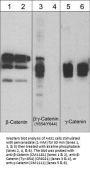 Anti-β-Catenin (Tyr-654) [γ-Catenin (Tyr-644)], Phosphospecific Antibody