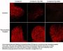 Anti-β-Catenin (Tyr-654) [γ-Catenin (Tyr-644)], Phosphospecific Antibody