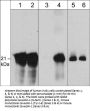 Anti-Caveolin-1 (Tyr-14), Phosphospecific Antibody