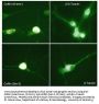 Anti-Cofilin 1 (N-terminus) Antibody