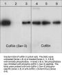Anti-Cofilin 1 (Ser-3), Phosphospecific Antibody