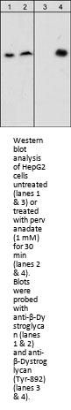 Anti-β-Dystroglycan (Tyr-892), Phosphospecific Antibody