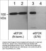 Anti-eEF2K (Ser-78), Phosphospecific Antibody