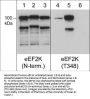 Anti-eEF2K (Thr-348), Phosphospecific Antibody