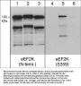 Anti-eEF2K (Ser-359), Phosphospecific Antibody
