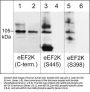 Anti-eEF2K (Ser-398), Phosphospecific Antibody