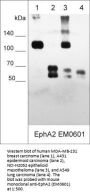 Anti-EphA2 (Extracellular region) M060 Antibody