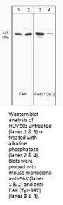 Anti-FAK (Tyr-397), Phosphospecific Antibody