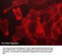 Anti-FXYD5/Dysadherin (Extracellular region) Antibody