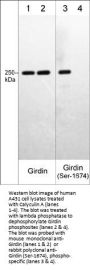 Anti-Girdin (Ser-1674), Phosphospecific Antibody
