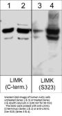Anti-LIMK1 (Ser-323) [LIMK2 (Ser-314)], Phosphospecific Antibody