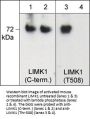 Anti-LIMK1 (Thr-508) [LIMK2 (Thr-505], Phosphospecific Antibody