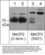 Anti-MeCP2 (Ser-421), Phosphospecific Antibody