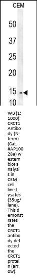 CRCT1 Antibody (N-term)