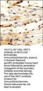 CRCT1 Antibody (N-term)