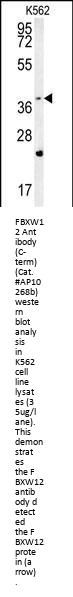 FBXW12 Antibody (C-term)