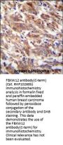 FBXW12 Antibody (C-term)