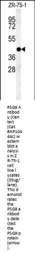 PSG9 Antibody  (Center)