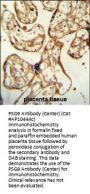 PSG9 Antibody  (Center)