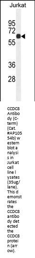 CCDC8 Antibody (C-term)