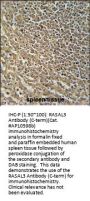 RASAL3 Antibody (C-term)