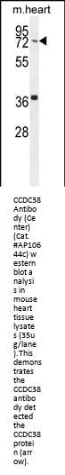 CCDC38 Antibody (Center)