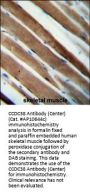 CCDC38 Antibody (Center)