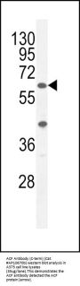ACF Antibody (C-term)