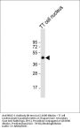 NKX2-1 Antibody (N-term)