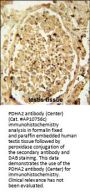 PDHA2 Antibody (Center)