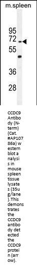 CCDC9 Antibody  (N-term)
