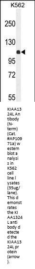 KIAA1324L Antibody (N-term)