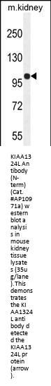 KIAA1324L Antibody (N-term)