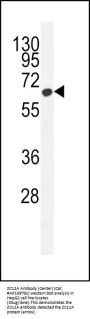 ZC12A Antibody (Center)