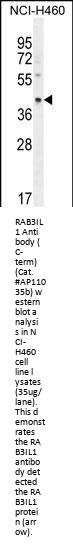 RAB3IL1 Antibody (C-term)