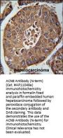 ACN9 Antibody  (N-term)