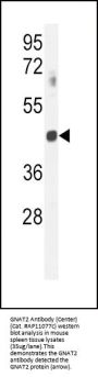 GNAT2 Antibody (Center)