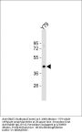 GNAT2 Antibody (Center)