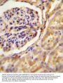 GNAT2 Antibody (Center)