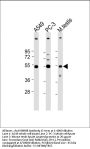 INHBB Antibody (C-term)