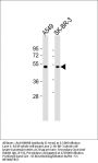 INHBB Antibody (C-term)