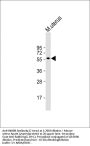 INHBB Antibody (C-term)