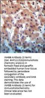 INHBB Antibody (C-term)