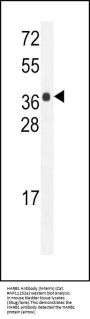 HARB1 Antibody  (N-term)