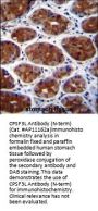 CPSF3L Antibody (N-term)