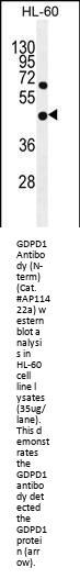 GDPD1 Antibody  (N-term)