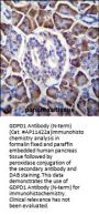 GDPD1 Antibody  (N-term)