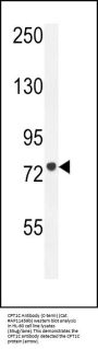 CPT1C Antibody (C-term)