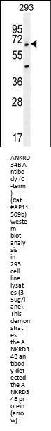ANKRD34B Antibody (C-term)