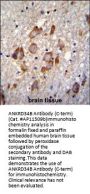 ANKRD34B Antibody (C-term)